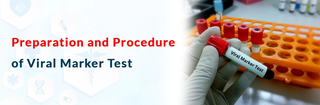 What Are the Preparation and Procedure of Viral Marker Test?